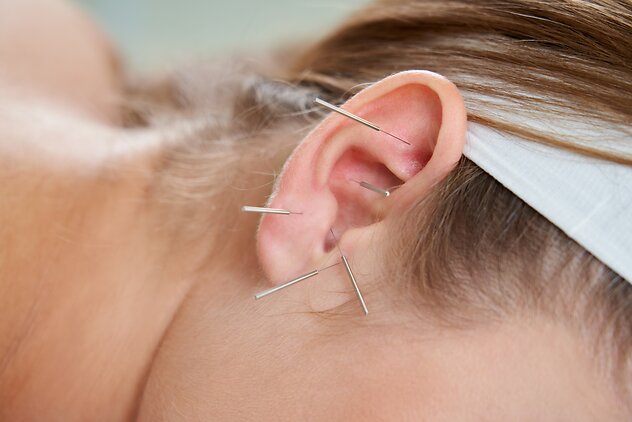 Auricular Acupuncture. Acupuncture Banner